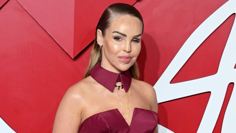 Katie Piper deler beslutningen om Ã¥ fÃ¥ kunstig Ã¸ye 16 Ã¥r etter syreangrep