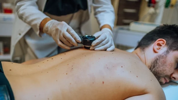 Hudlege undersøker pasientens hudføflekker med dermoskop på klinikken